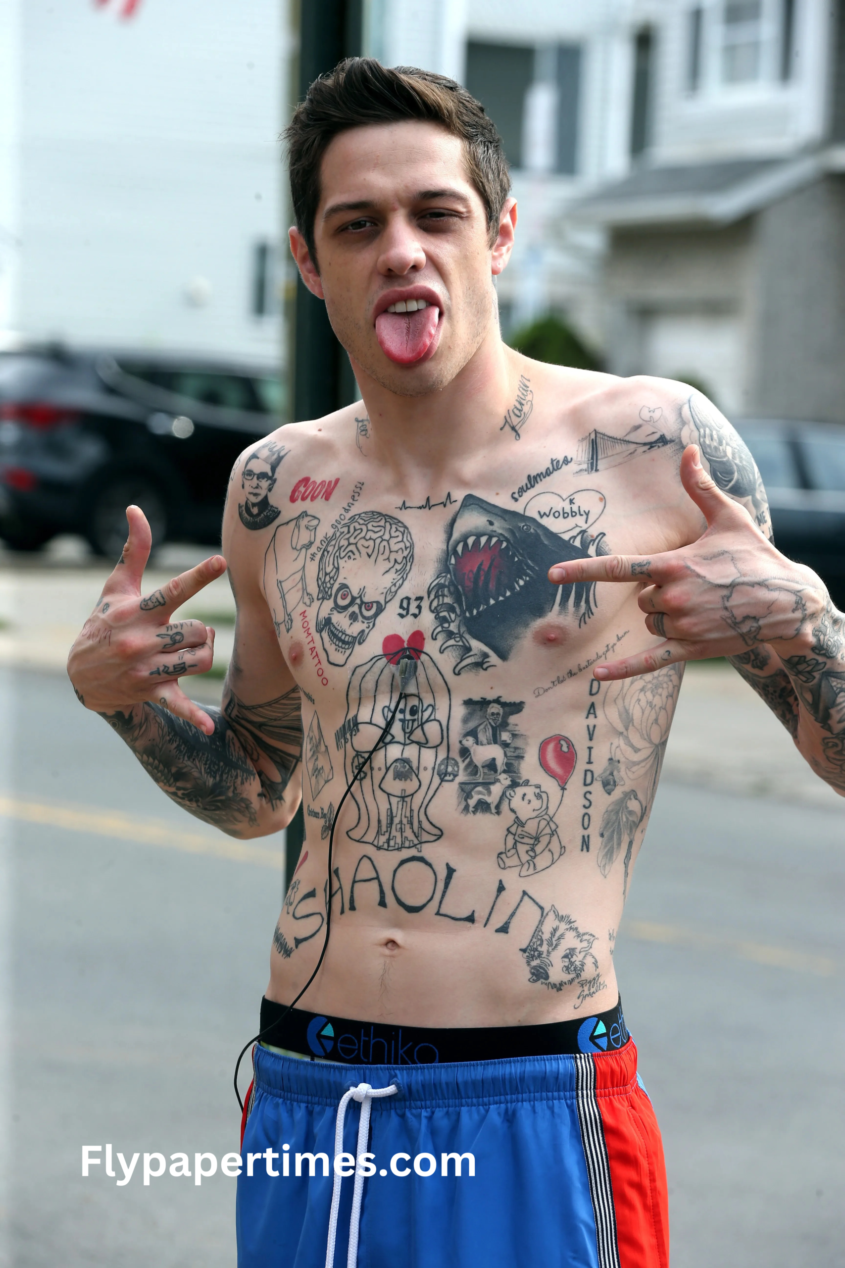 pete davidson tattoo removal